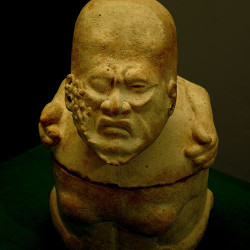 An Olmec figurine depicting a diseased man